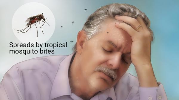 Dengue Fever Illustration